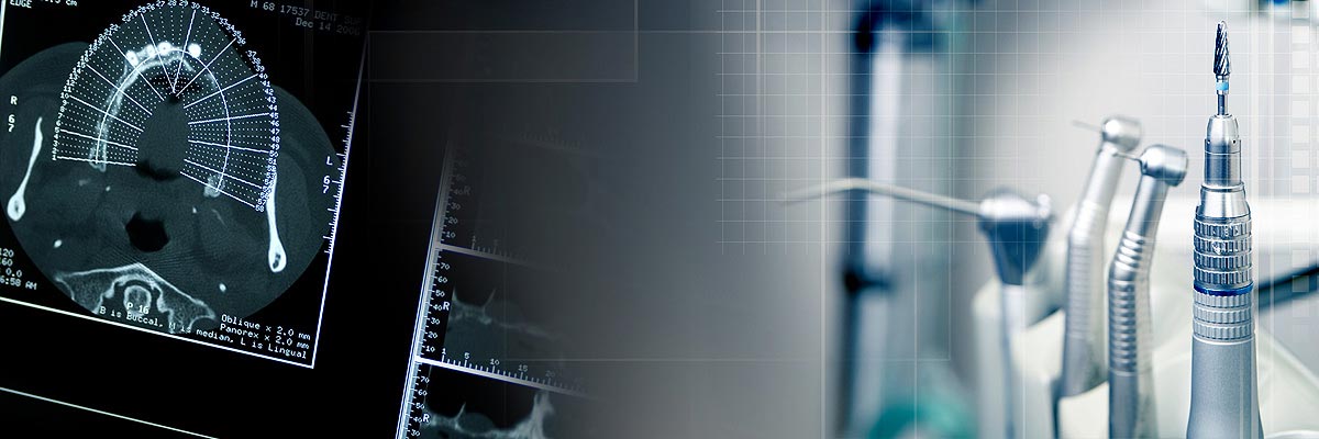 Dothan Will I Need a Bone Graft for Dental Implants?