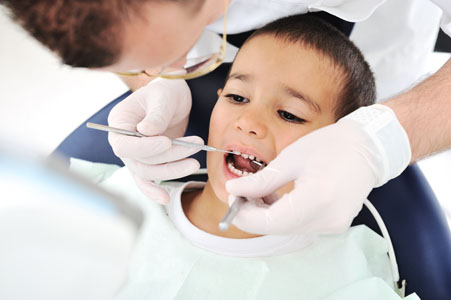 Dental Sealants