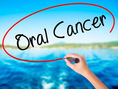 Oral Cancer Screening