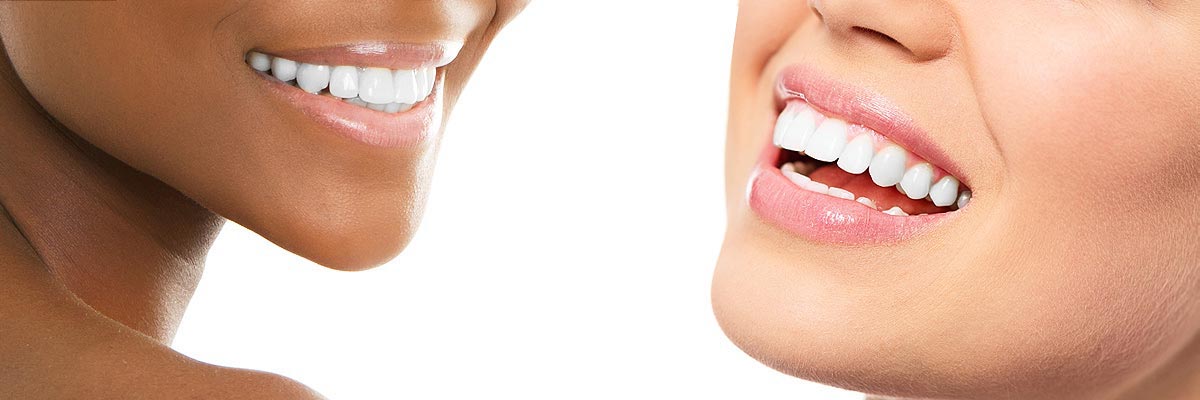 Dothan Teeth Whitening