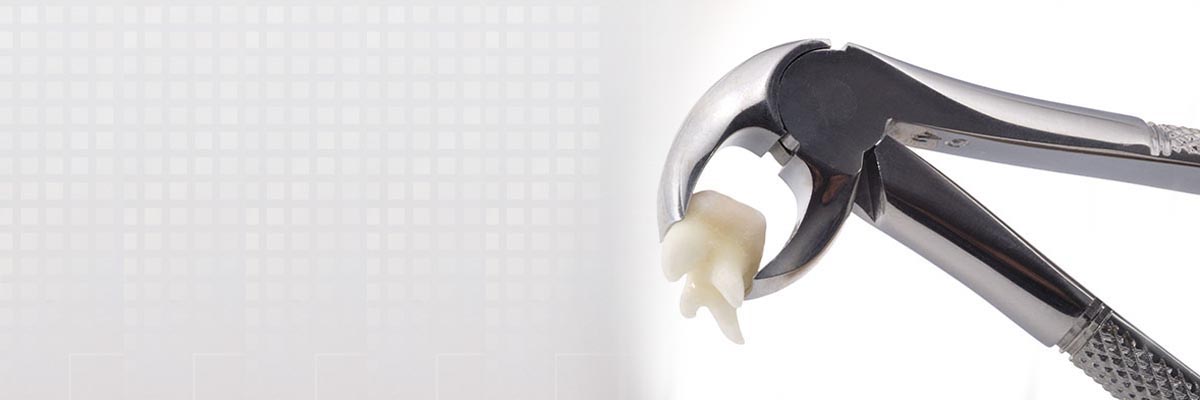 Dothan Tooth Extraction